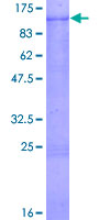 12.5% SDS-PAGE Stained with Coomassie Blue.